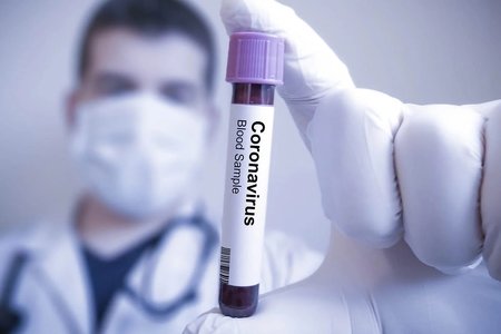 Koronavirusla bağlı Azərbaycandakı vəziyyətə dair mətbuat konfransı keçiriləcək