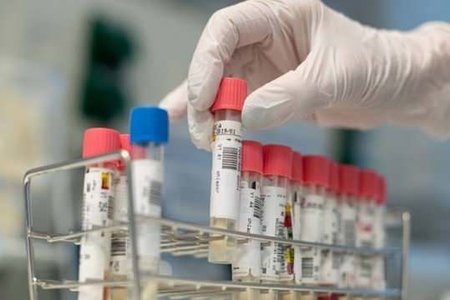 Koronavirus yavaş-yavaş “gəlir” - 560 nəfər karantindədir