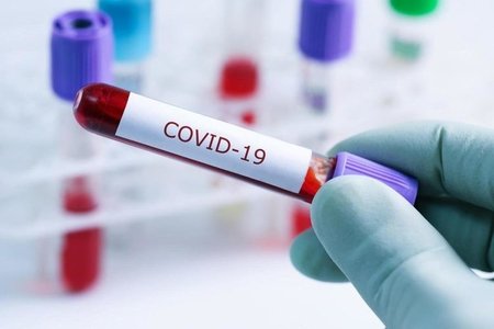 Azərbaycanda daha 17 nəfər koronavirusa yoluxub, 1 nəfər ölüb