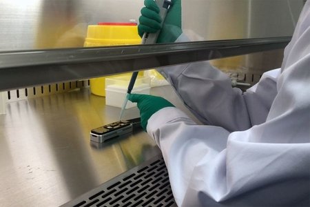 Hazırda Azərbaycanda 163 aktiv koronavirus xəstəsi həkim nəzarətindədir, onlardan 23-nün vəziyyəti ağırdır