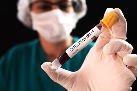 Epidemioloq COVID-19-dan daha təhlükəli infeksiyanın yaranma riski barədə xəbərdar edib