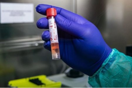 Ermənistan koronavirusun yayılmasının nəzarətdən çıxdığını açıqladı