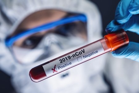 Azərbaycanda daha 38 nəfər koronavirusa yoluxub, 30 nəfər sağalıb