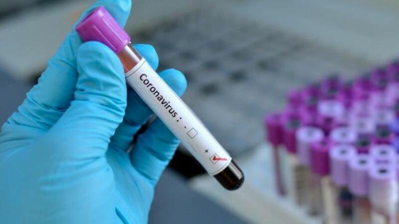Koronavirus peyvəndinin qiyməti AÇIQLANDI