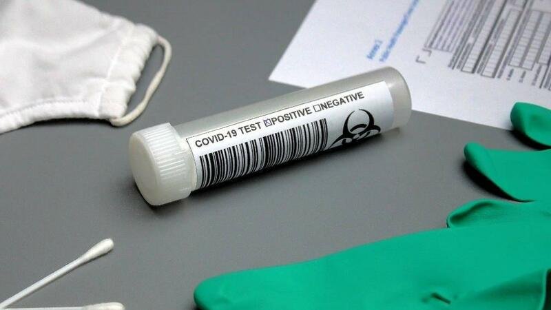 İsrail alimləri koronavirusu saniyələr ərzində müəyyən edən test hazırladı