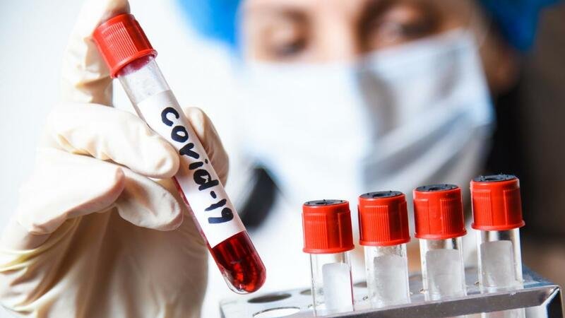 Qonşu ölkədə virus bir gündə 14 can aldı