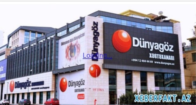 DünyaGöz" klinikasından ŞİKAYƏT - "Çəplik düzəlməyib, görmə qabiliyyətim də zəifləyib"