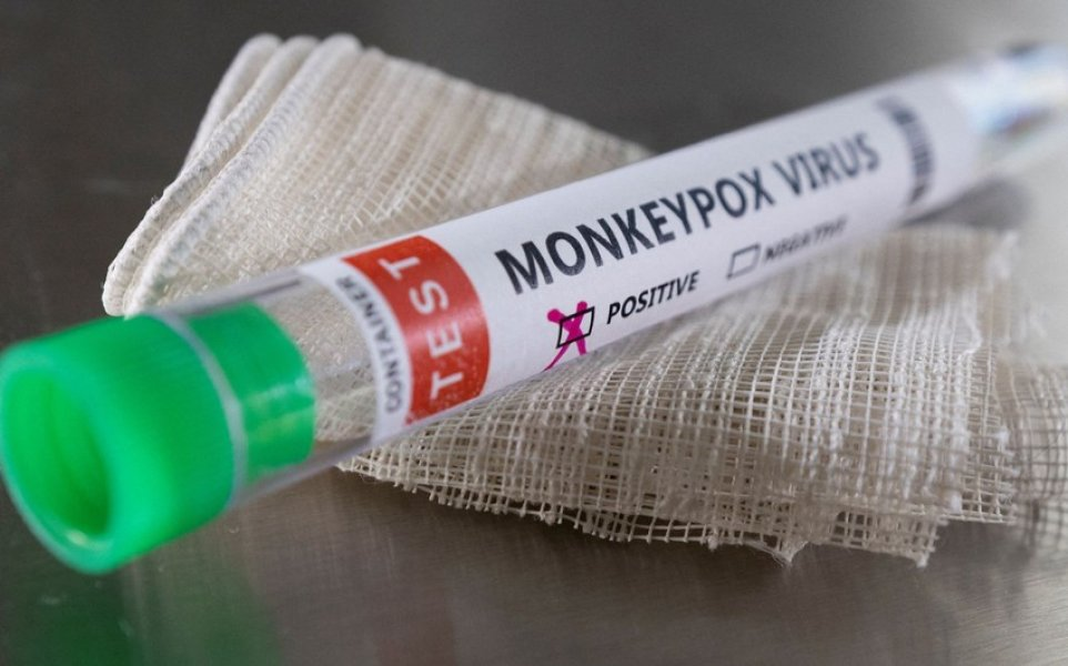 BƏƏ-də meymunçiçəyinə beş yeni yoluxma aşkarlandı