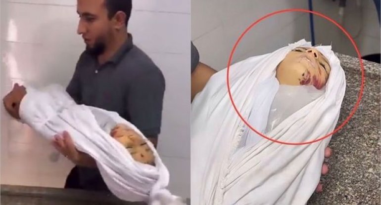 SAXAL-ın hücumu ilə “ölən uşaqlar”ın oyuncaq olduğu ortaya çıxdı - VİDEO