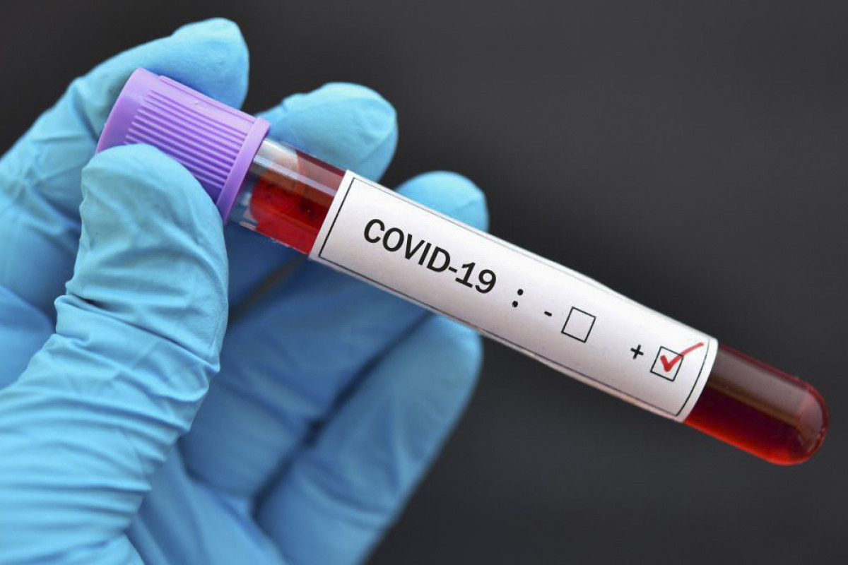 COVID-19-la mübarizə aparan tibb işçilərinin maaşlarına əlavənin müddəti artırılıb