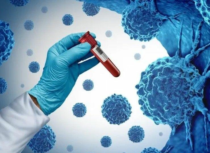 Xərçəngin peyvəndi tapıldı