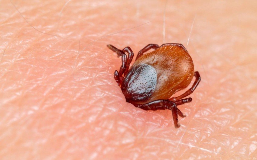 Beyinə təsir edən yeni virus yayılıb - Bu üsulla keçir...
