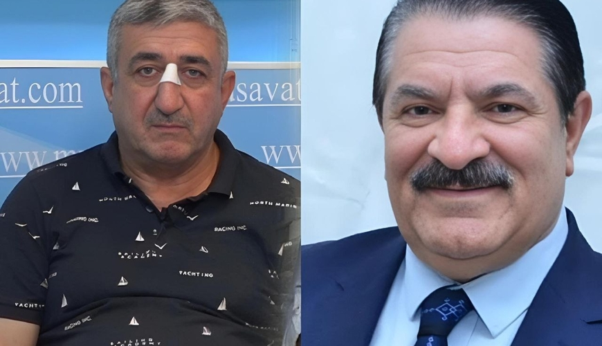 Ağadadaş Ağayevin balta atdığı mühafizəçi həbs edilib - ÖZƏL