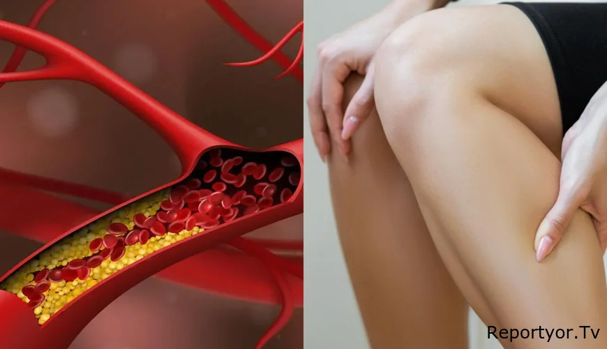 Qan laxtalanması problemi genetik imiş