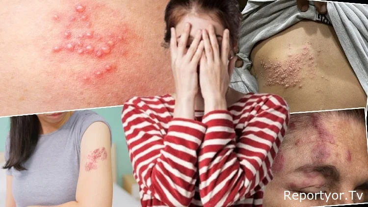 "Evdə qapandım, çölə çıxa bilmədim" - Başına gələn DƏHŞƏTDƏN danışdı